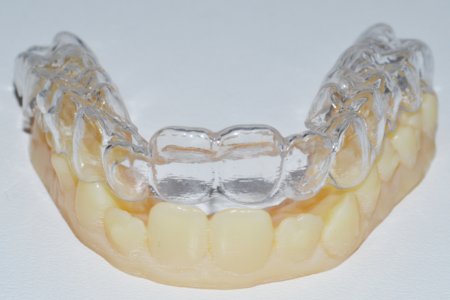 Aligner mascherine trasparenti-1